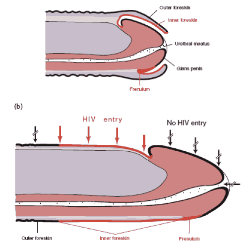 Обрезанный И Необрезанный У Мужчин Фото